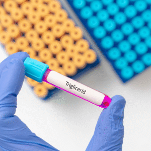 Triglicerid: a tested „rejtett üzemanyaga”